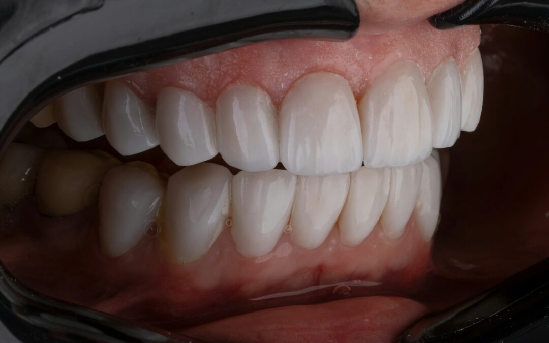 Tooth Enamel Repair: Natural Ways to Strengthen Your Teeth