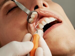 Oral Health Warning: The Hidden Connection to Heart Disease