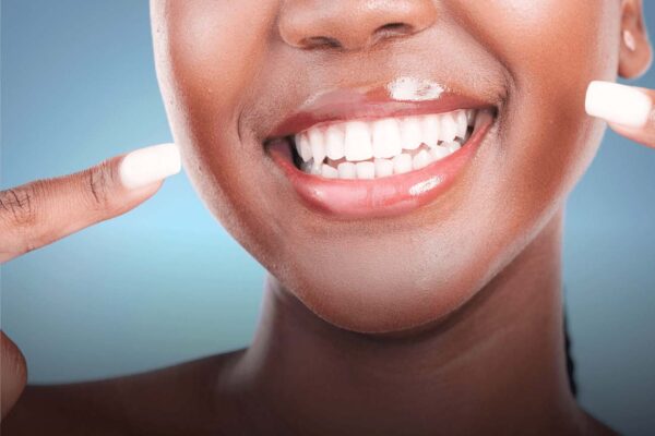 smilemakeover-in-phoenixville