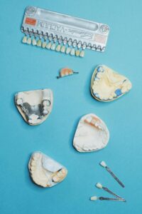Dental Bonding vs Veneers: Proven Pros and Cons Explained