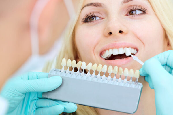 Veneers Longevity