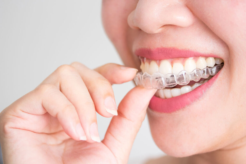 invisalign-phoenixville