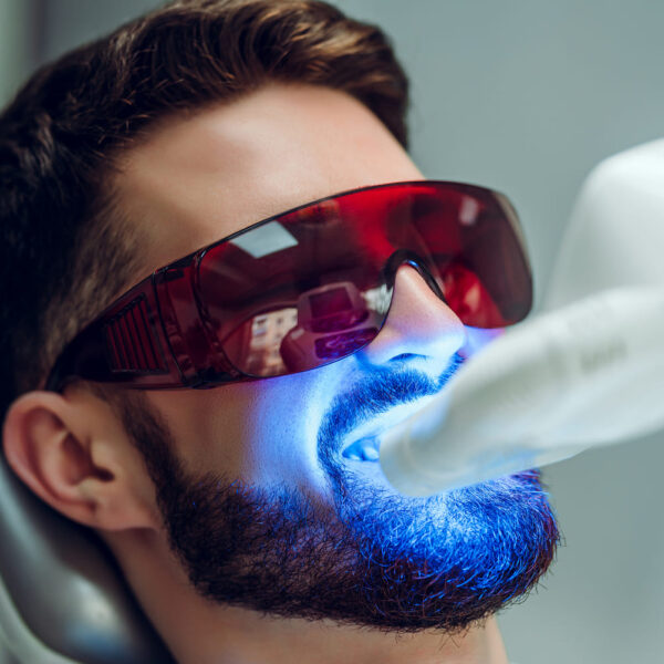 man-teeth-whitening