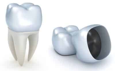 Can You Eat Hard Foods with a Permanent Crown? What Dentists Recommend