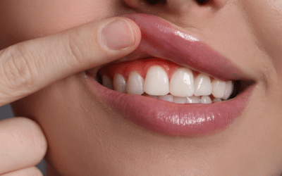 What Is the Best Mouthwash for Gum Disease?
