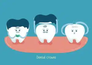 Signs that your dental crowns might be failing