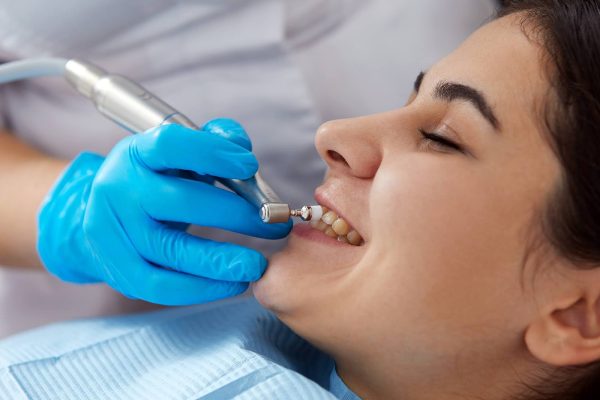 What causes tooth decay in young adults