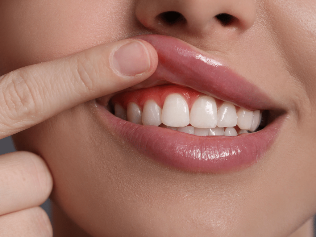 antimicrobial mouthwash for bleeding gums treatment