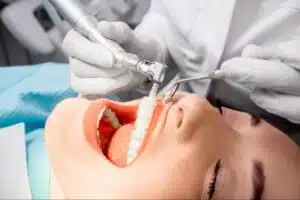 Regular dental cleaning for healthy teeth and gums