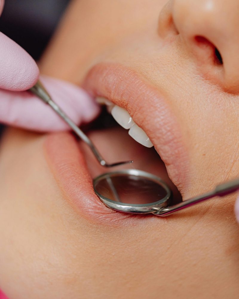 Affordable Dental Crowns in Phoenixville, PA